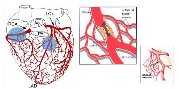 Non-Invasive Eecps Machine for Cardiac Rehabilitation with Automatic System